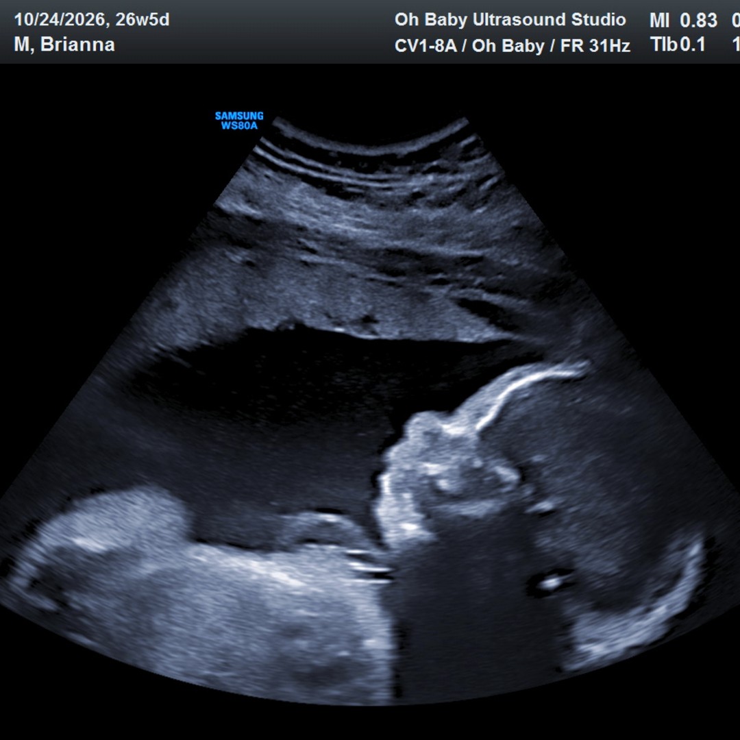 Photo shared by Brianna for their Babylist baby registry.