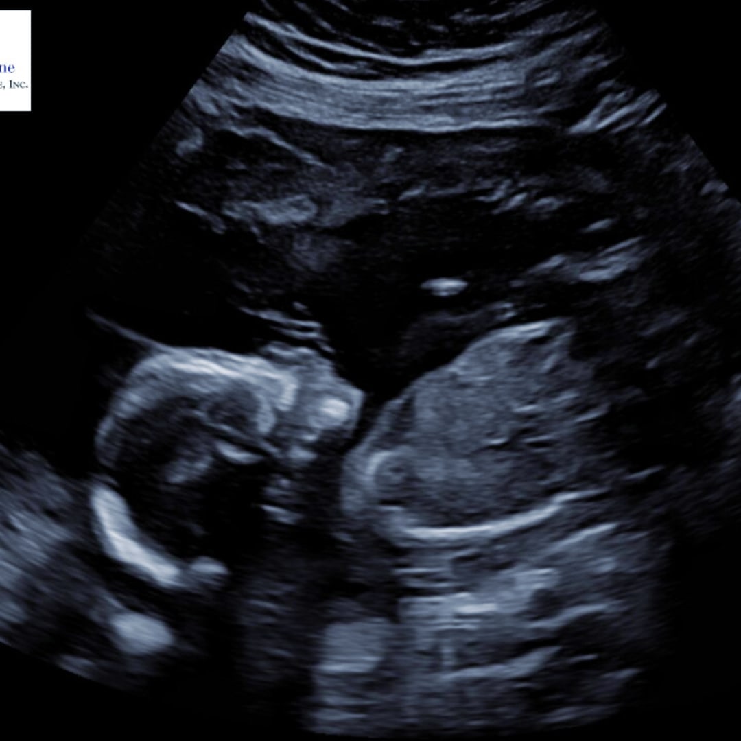 Photo shared by Asia for their Babylist baby registry.