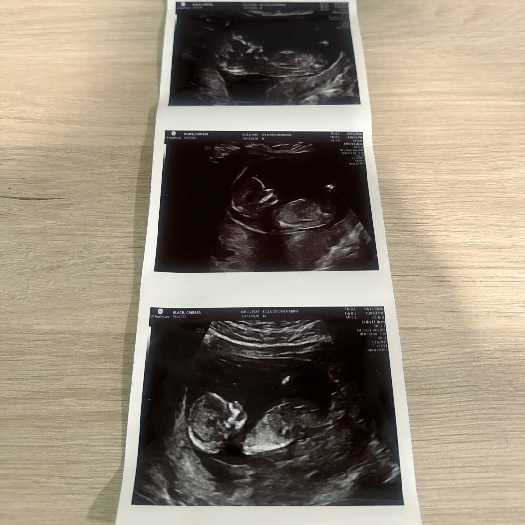 Photo shared by Carissa for their Babylist baby registry.