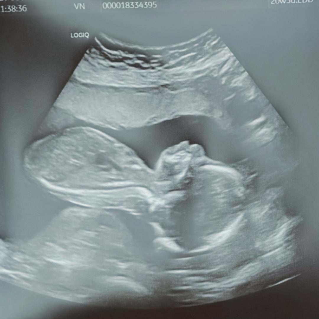 Photo shared by Katherine for their Babylist baby registry.