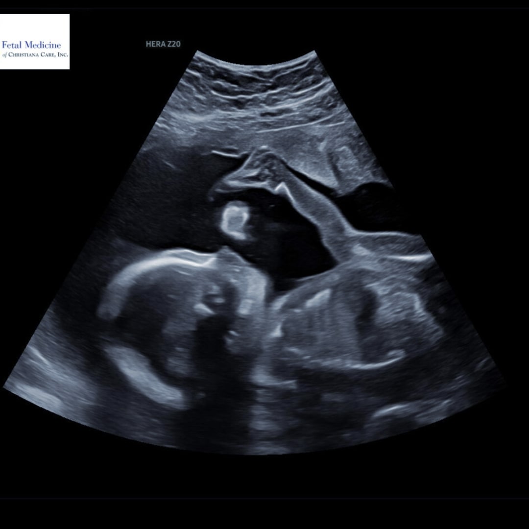 Photo shared by Victoria for their Babylist baby registry.