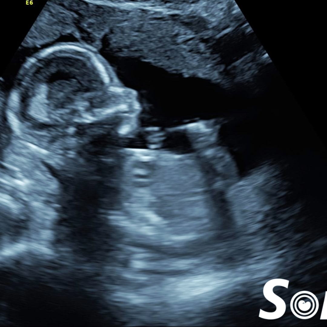 Photo shared by Amy for their Babylist baby registry.