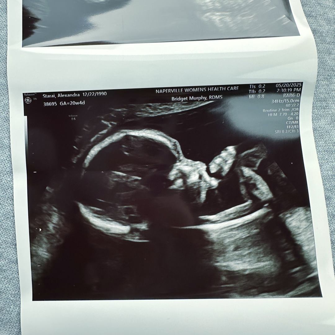 Photo shared by Alex for their Babylist baby registry.