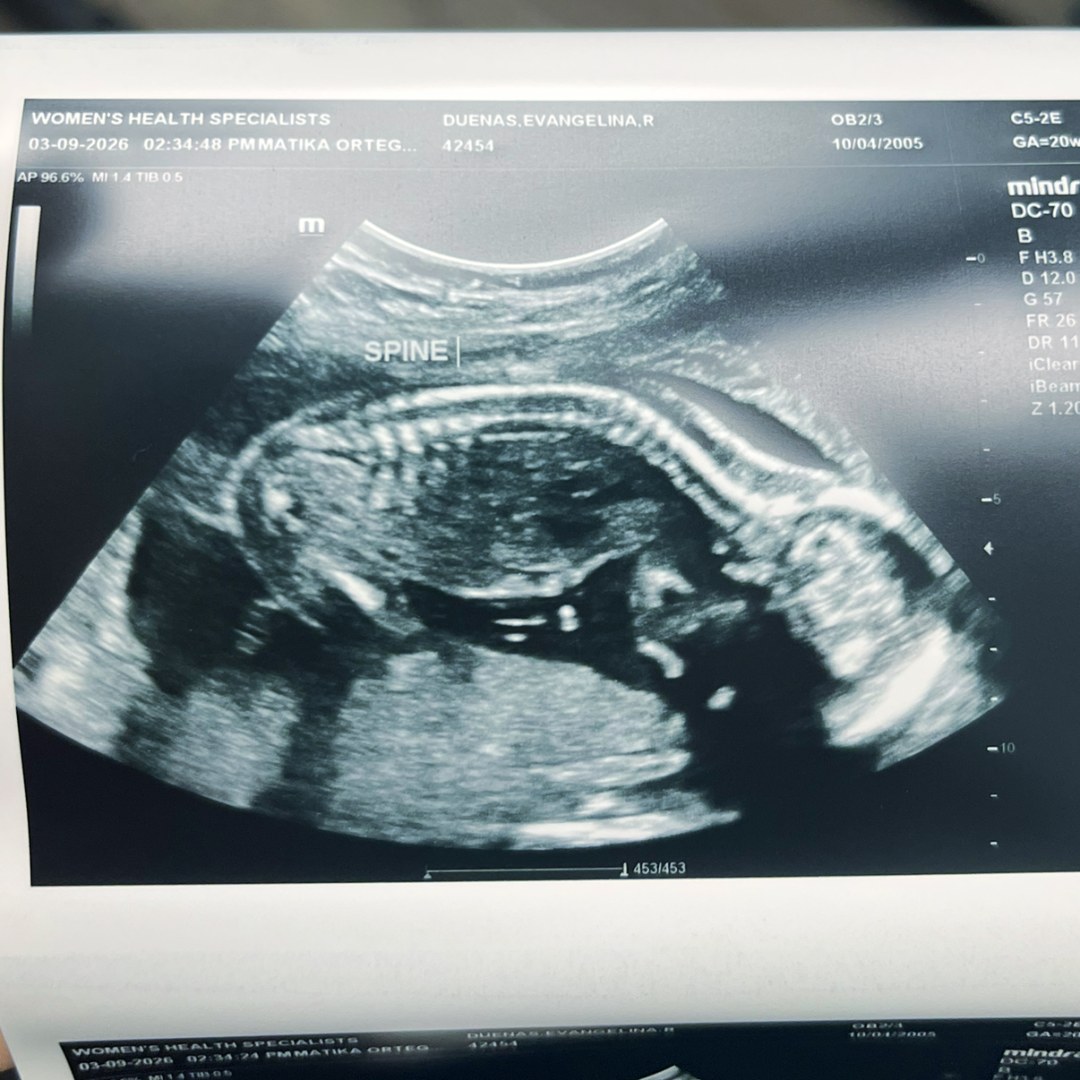 Photo shared by Lina for their Babylist baby registry.