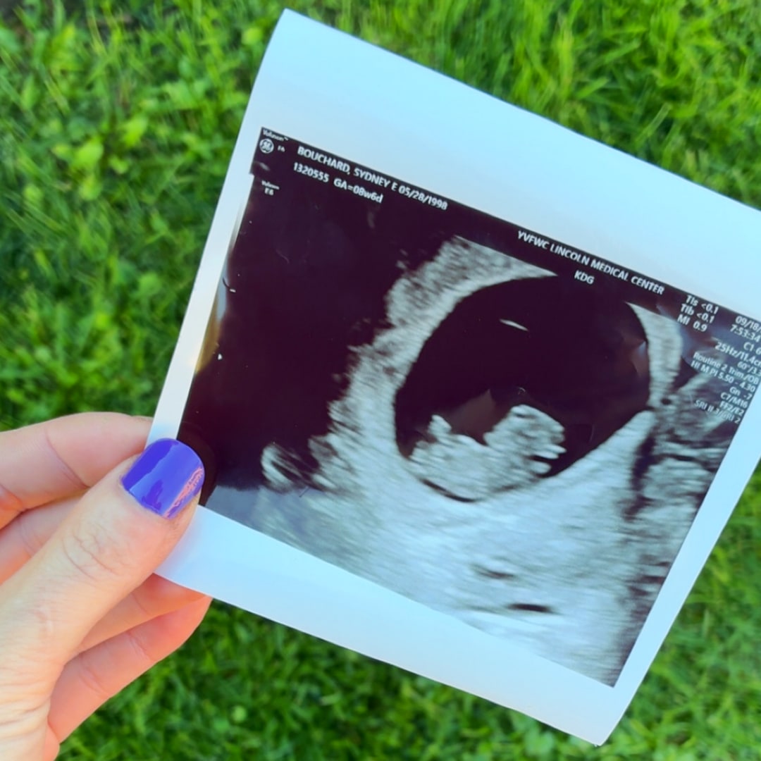 Photo shared by Sydney for their Babylist baby registry.