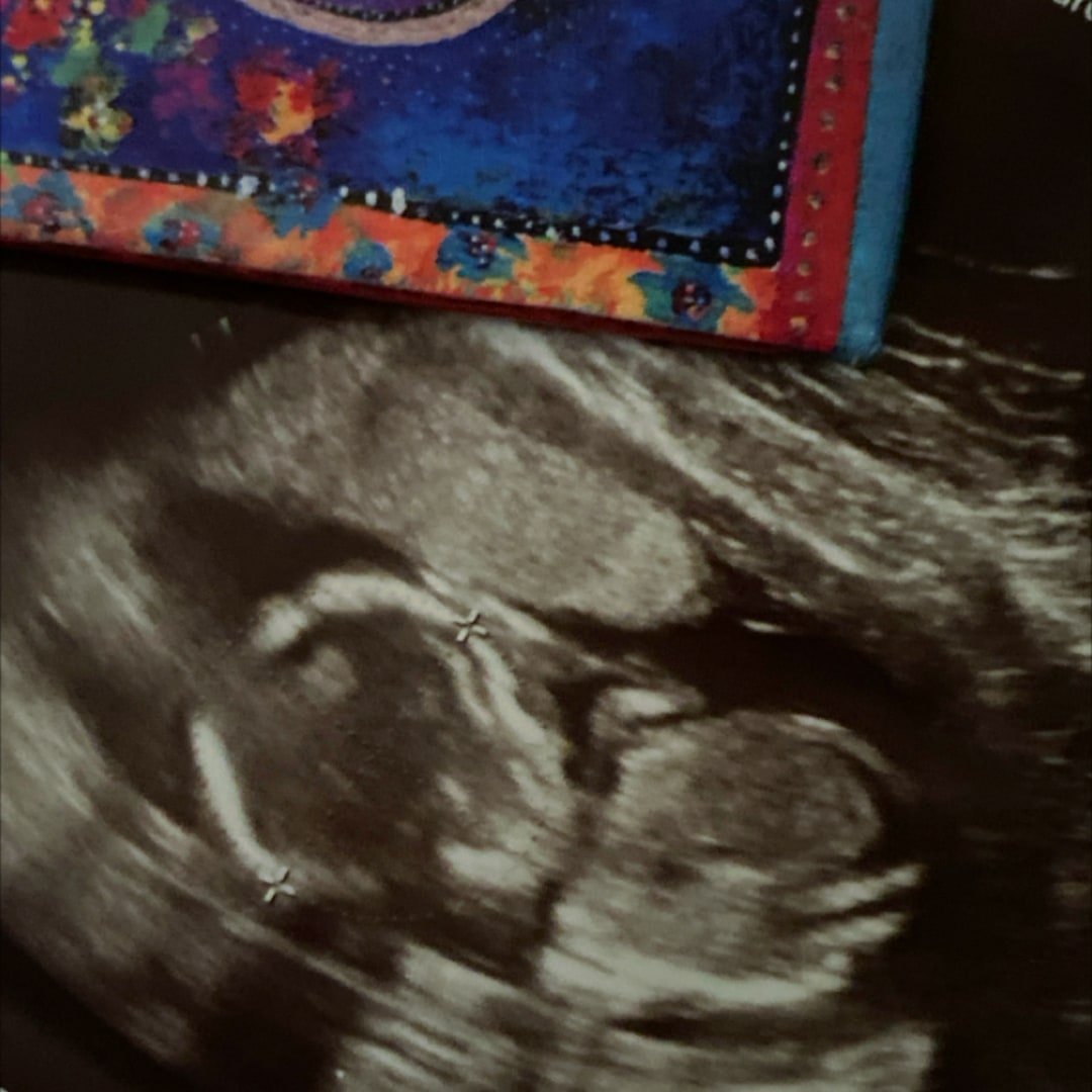 Photo shared by Amber for their Babylist baby registry.