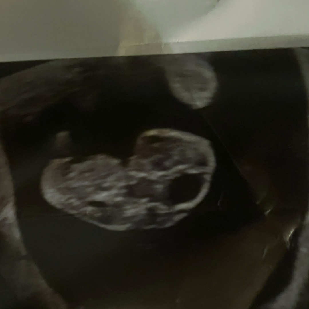 Photo shared by Hailee for their Babylist baby registry.