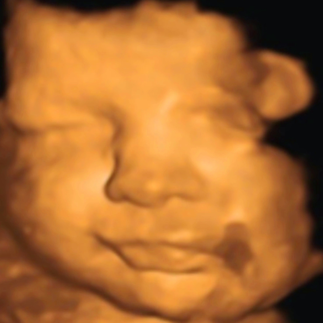 Photo shared by Sierra for their Babylist baby registry.