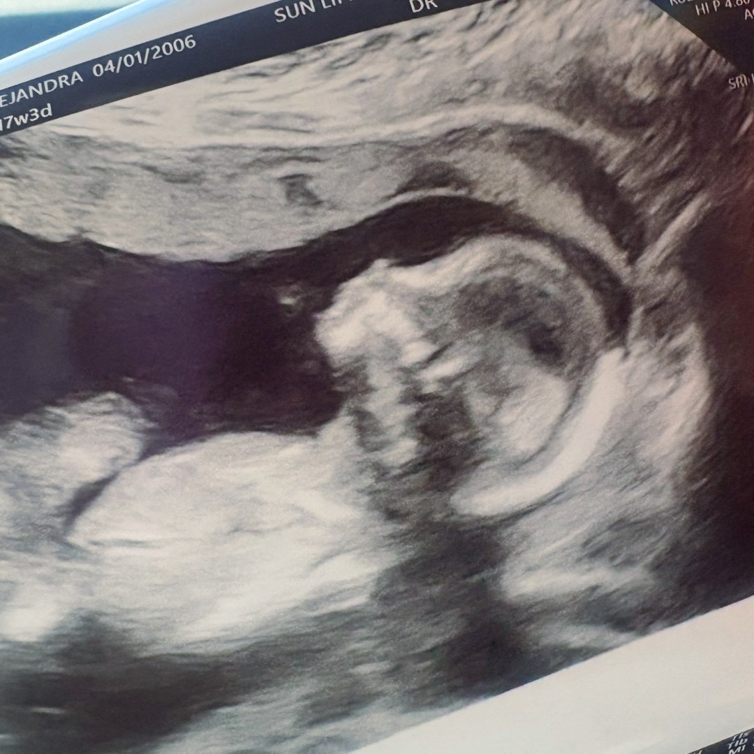 Photo shared by Alejandra for their Babylist baby registry.
