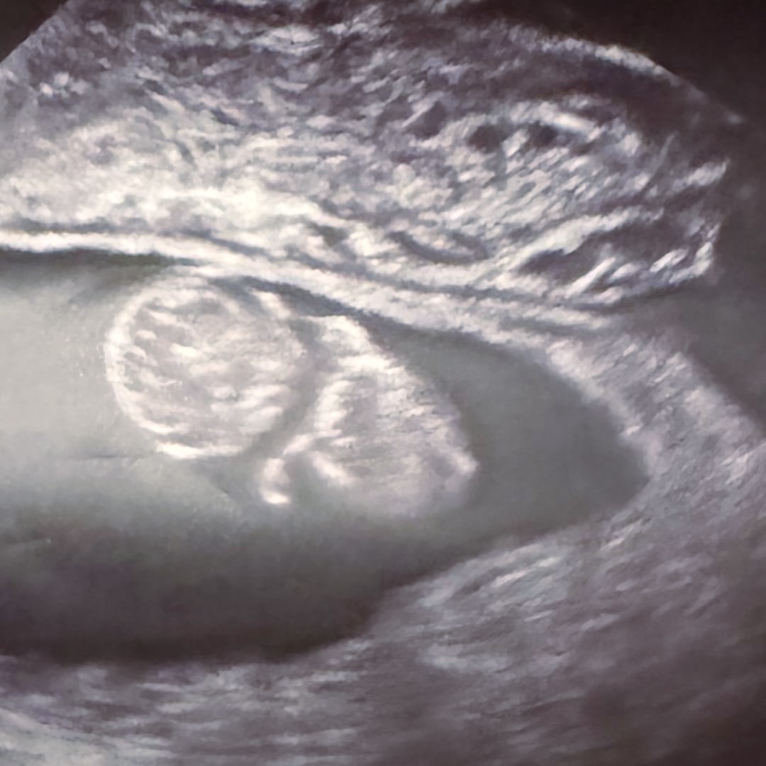 Photo shared by Robert for their Babylist baby registry.