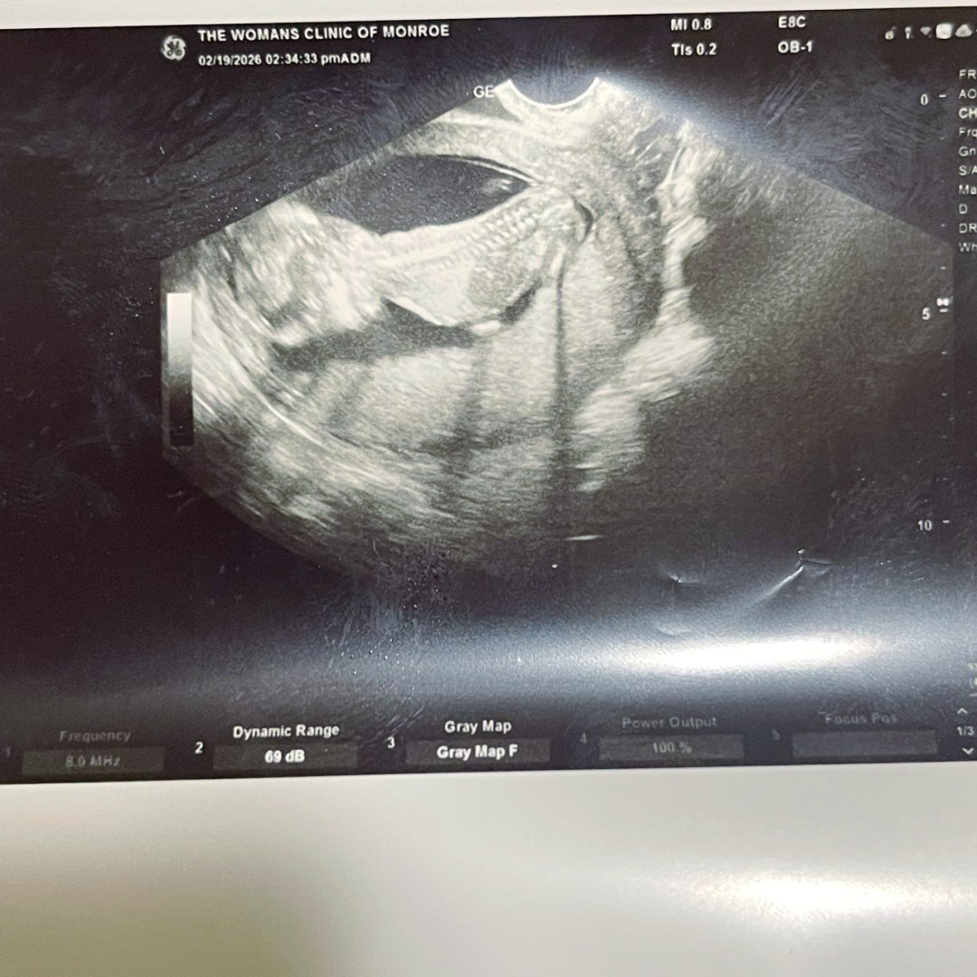 Photo shared by Ashlynn for their Babylist baby registry.