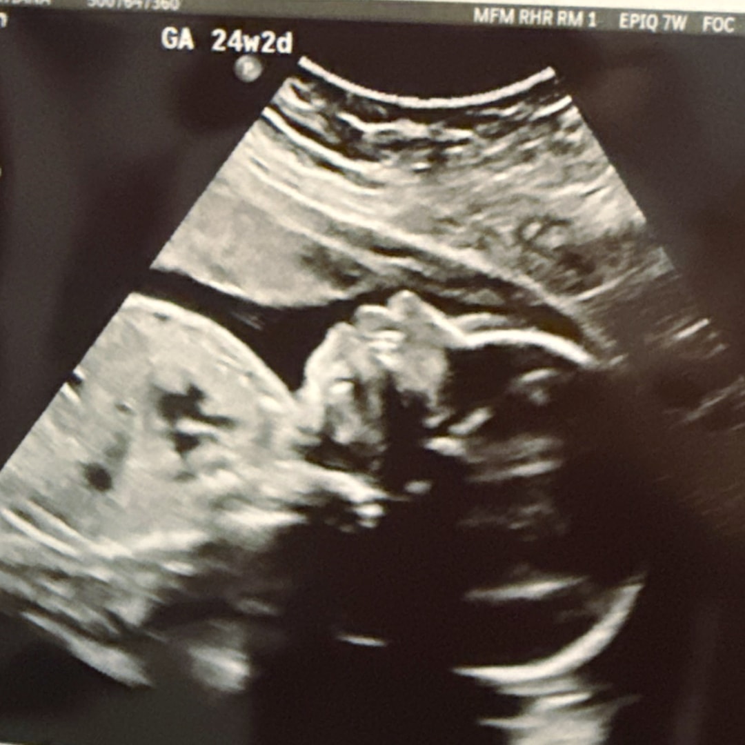 Photo shared by Tatiana for their Babylist baby registry.