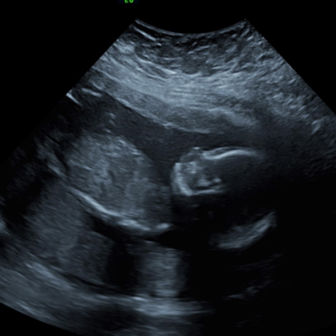 Photo shared by Peyton for their Babylist baby registry.