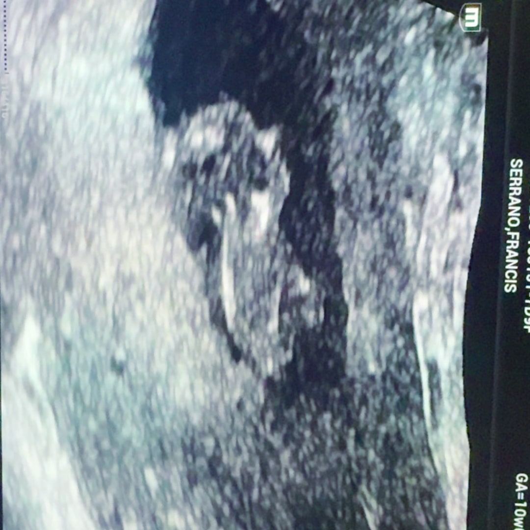 Photo shared by Francis for their Babylist baby registry.