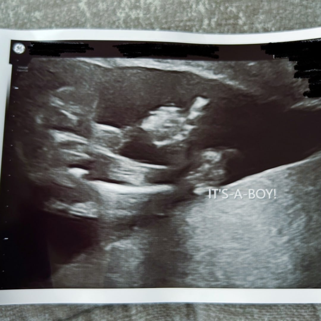 Photo shared by Erica for their Babylist baby registry.