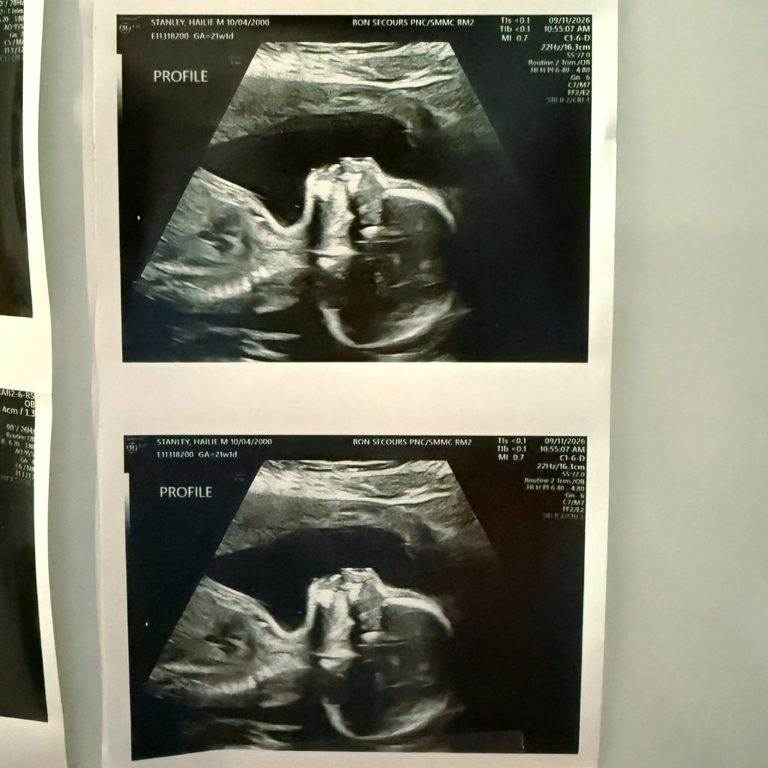 Photo shared by Hailie for their Babylist baby registry.