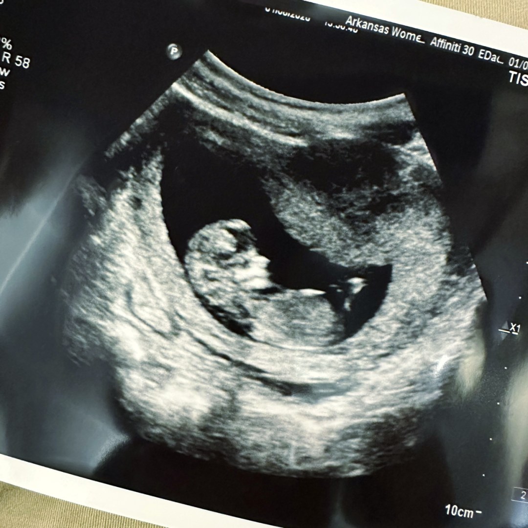 Photo shared by Kaylee for their Babylist baby registry.