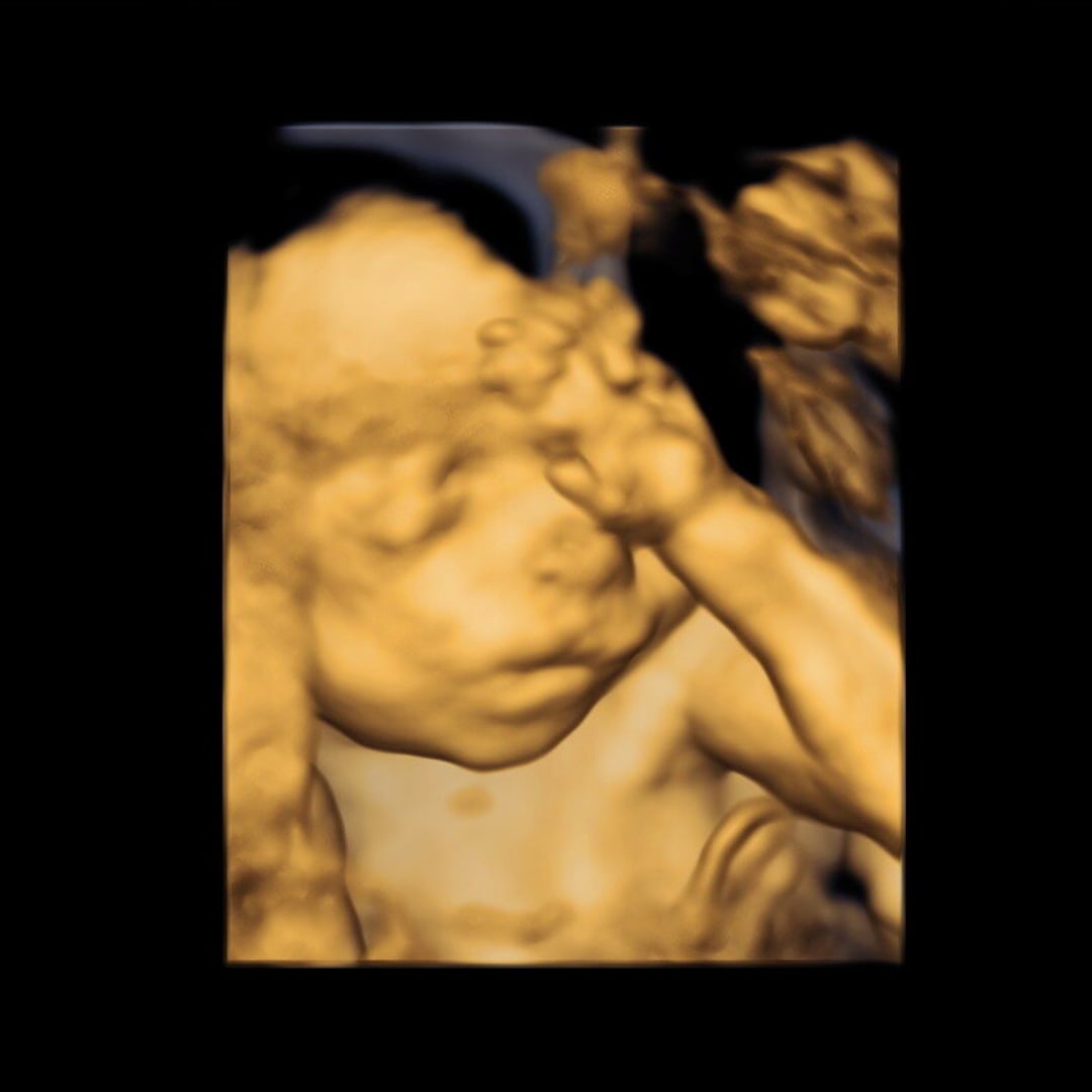 Photo shared by Brooke for their Babylist baby registry.