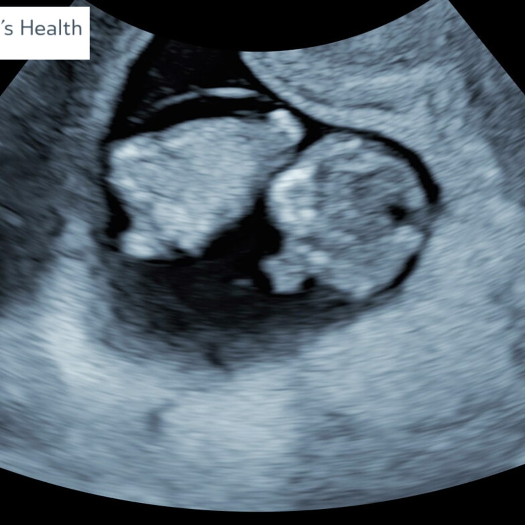 Photo shared by Chelsea for their Babylist baby registry.