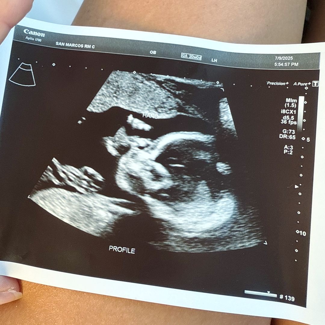 Photo shared by Lauren for their Babylist baby registry.