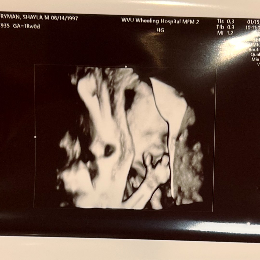 Photo shared by Shayla for their Babylist baby registry.