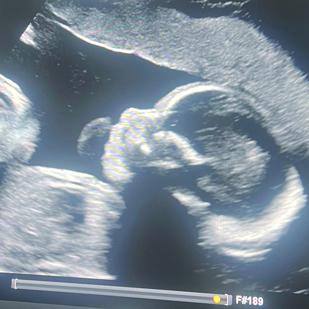 Photo shared by Edma for their Babylist baby registry.