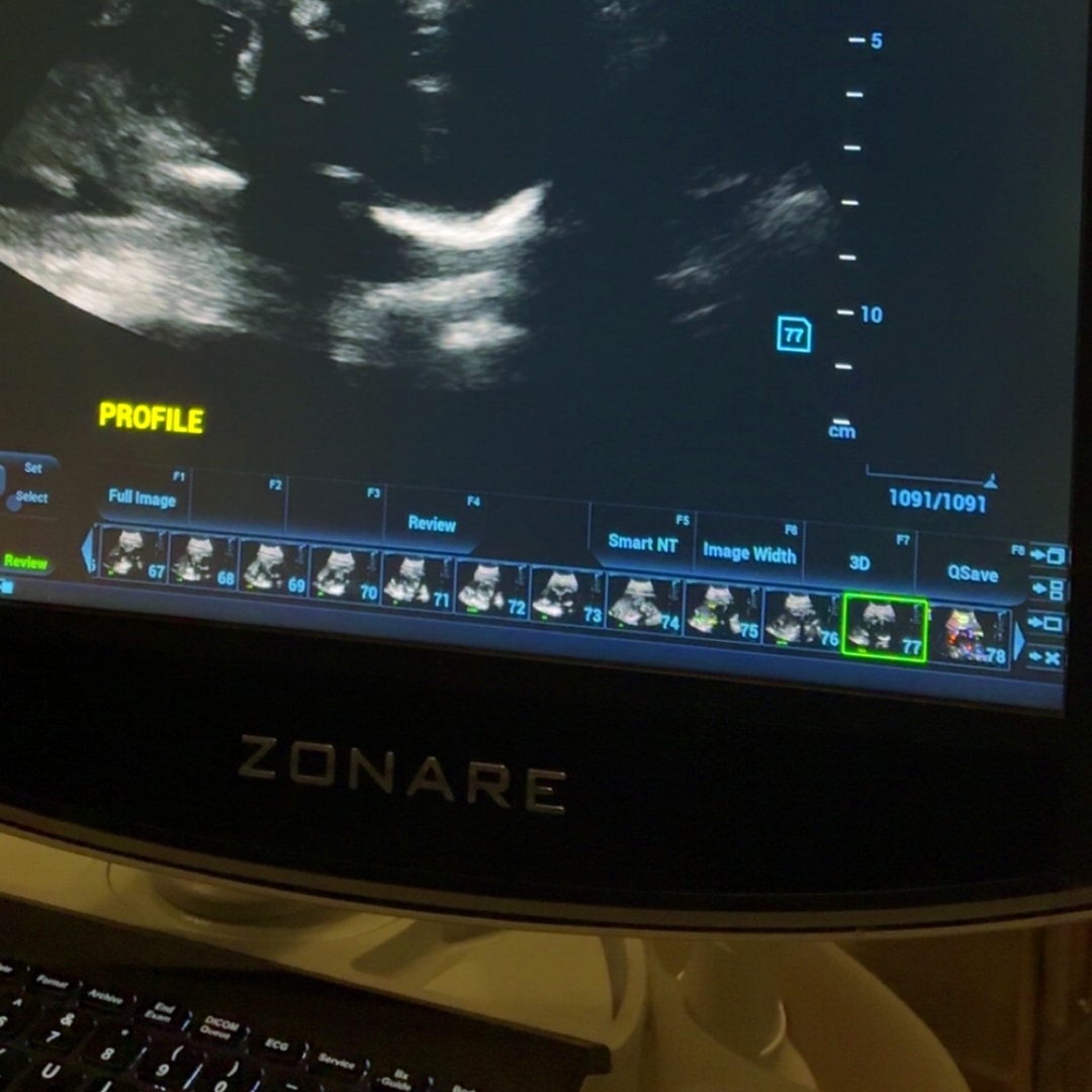 Photo shared by Sajobia for their Babylist baby registry.