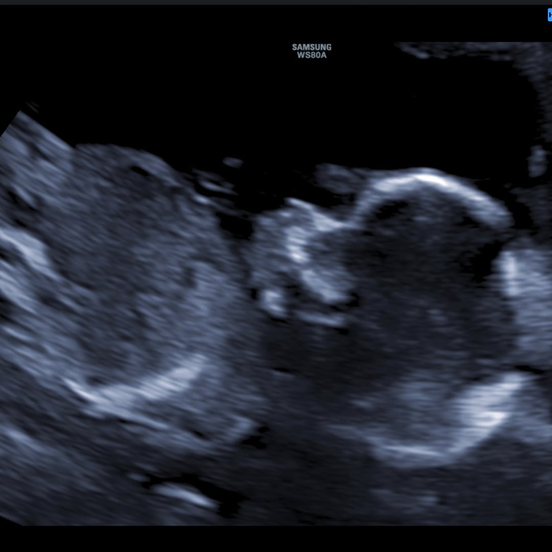 Photo shared by Desaree for their Babylist baby registry.