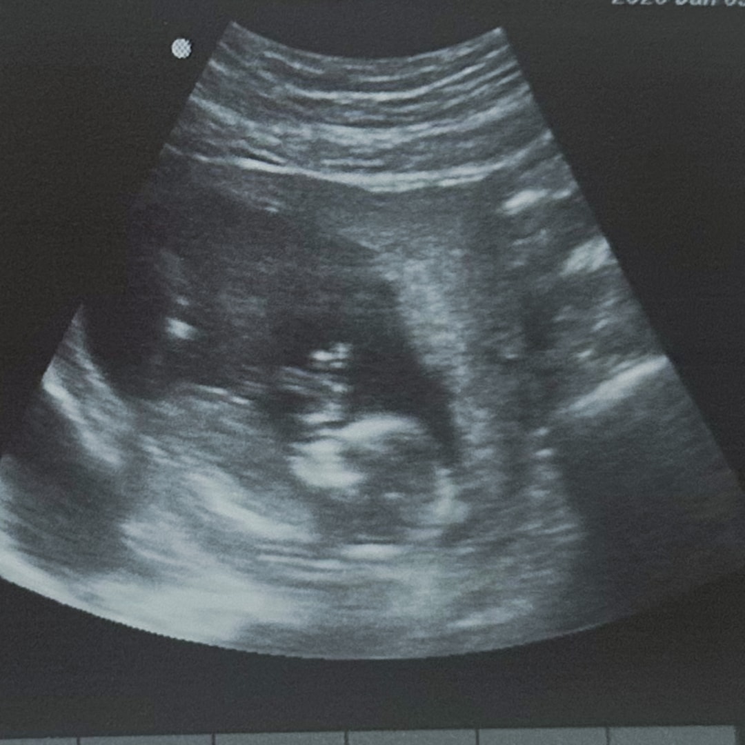 Photo shared by Adriana for their Babylist baby registry.