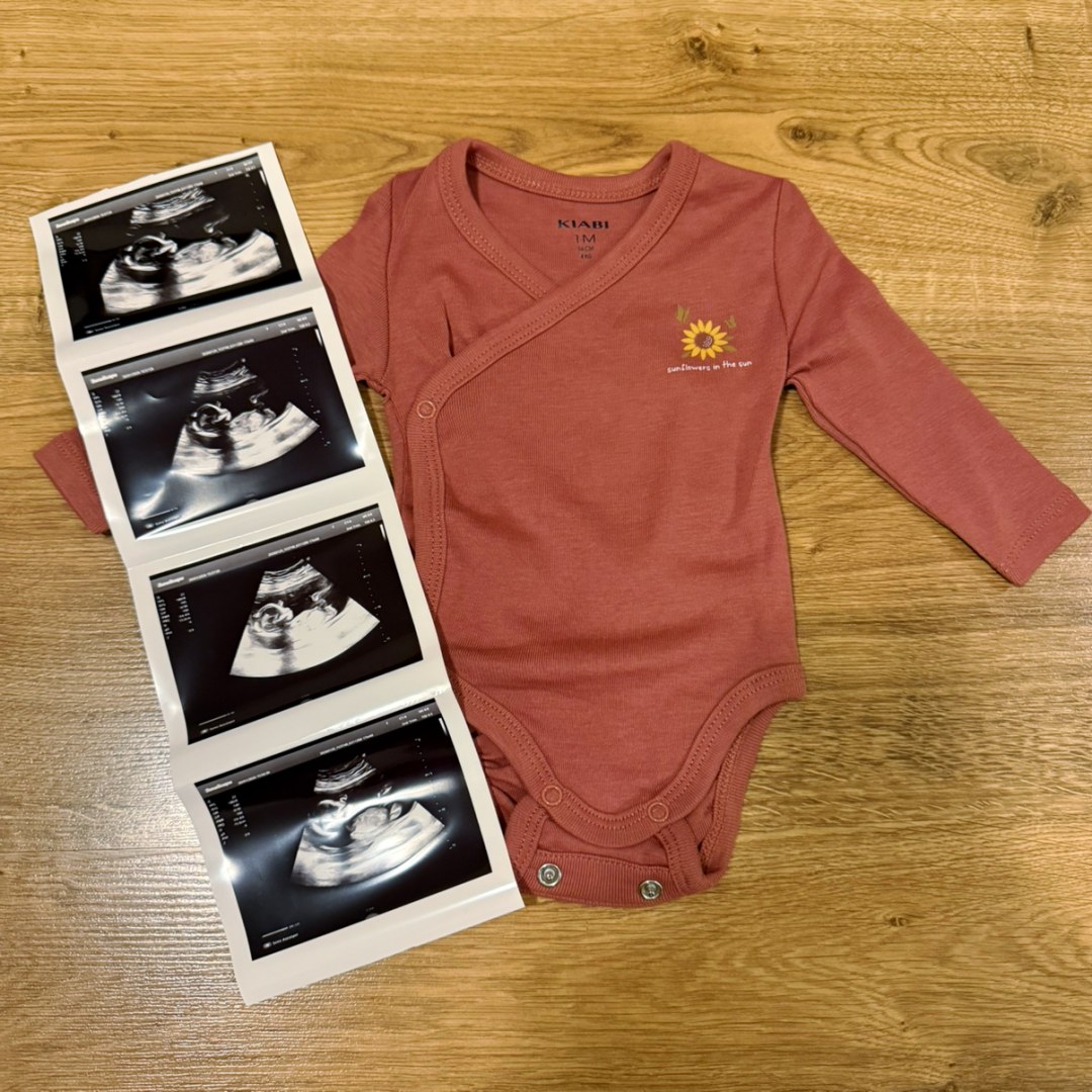 Photo shared by Austin and Bailey for their Babylist baby registry.