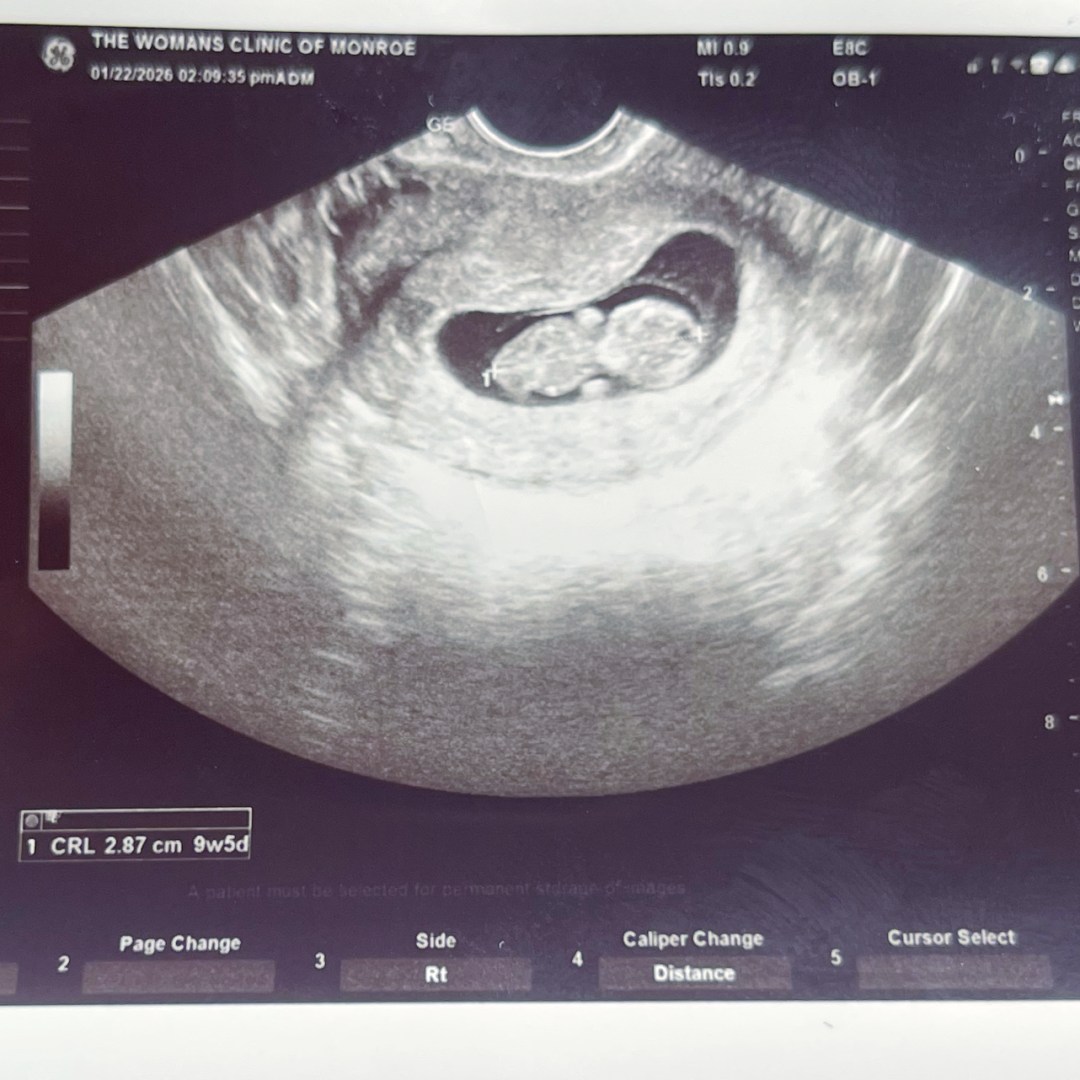 Photo shared by Ashlynn for their Babylist baby registry.