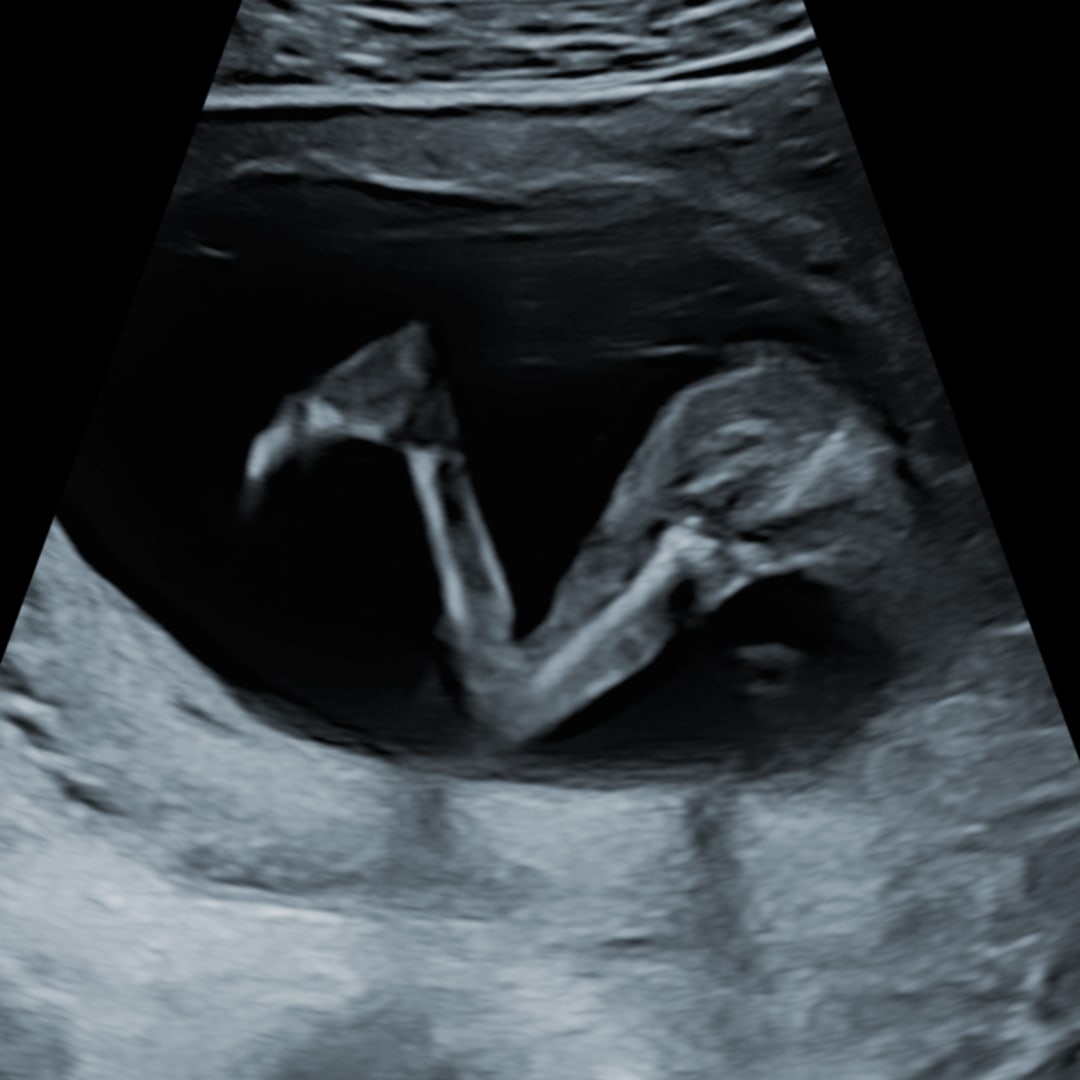 Photo shared by A for their Babylist baby registry.