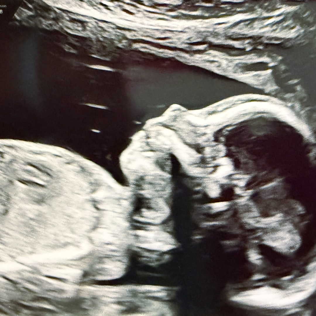 Photo shared by Allison for their Babylist baby registry.