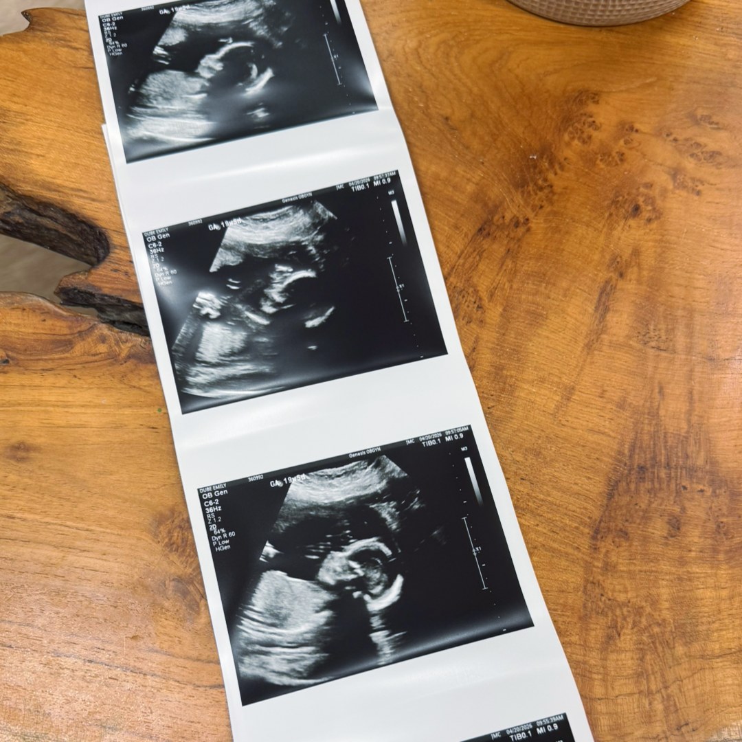 Photo shared by Emily for their Babylist baby registry.