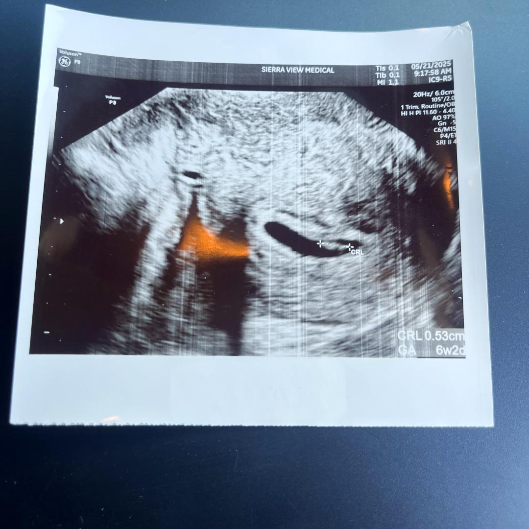 Photo shared by Chloe for their Babylist baby registry.