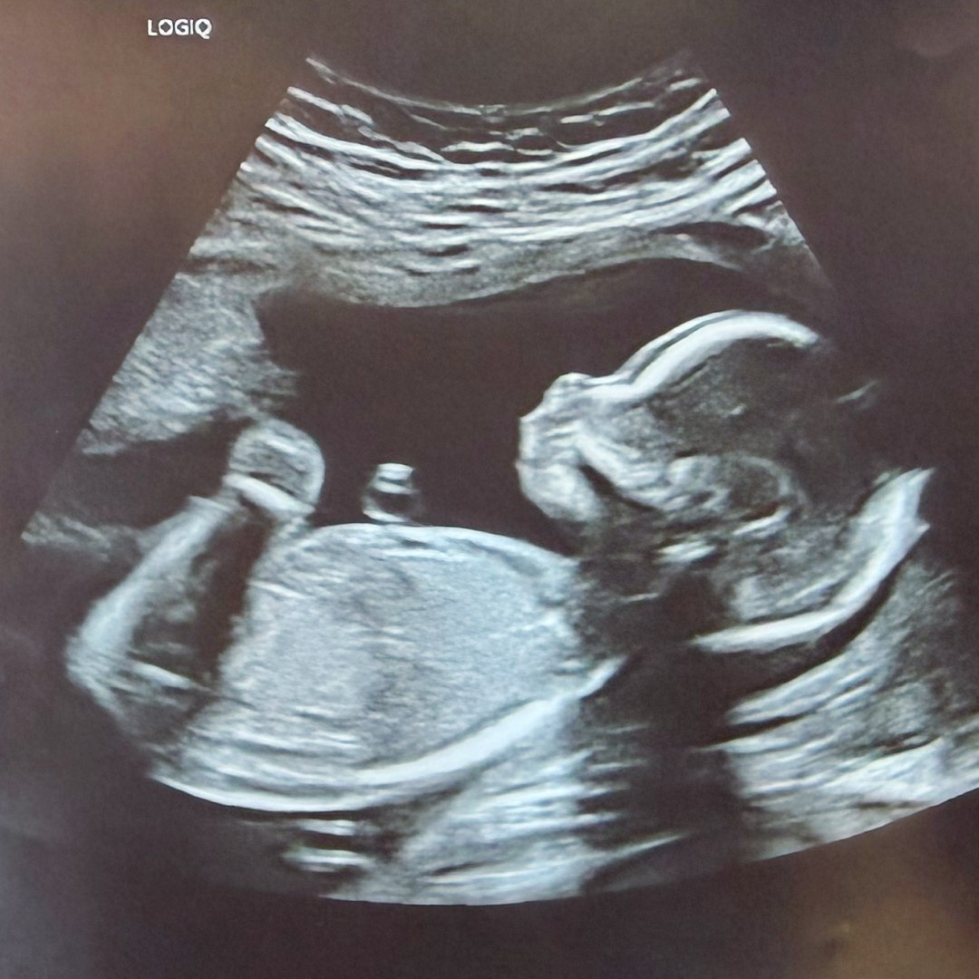 Photo shared by Aurora for their Babylist baby registry.