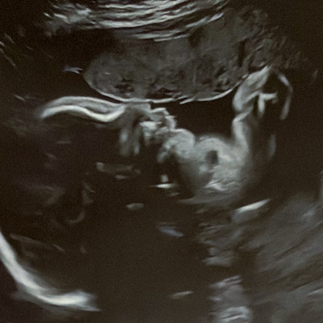 Photo shared by Erika for their Babylist baby registry.