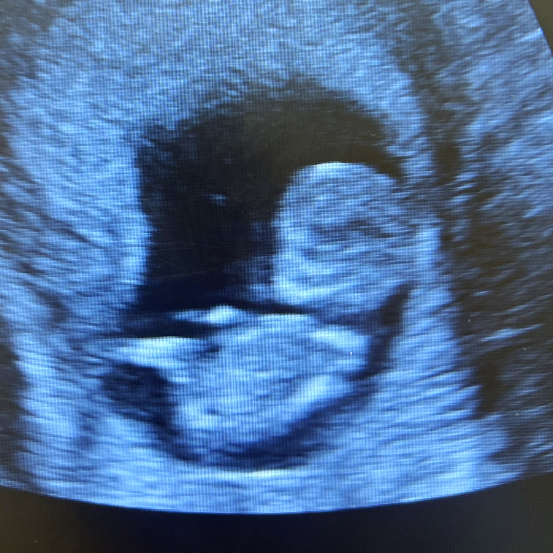 Photo shared by Stephanie for their Babylist baby registry.