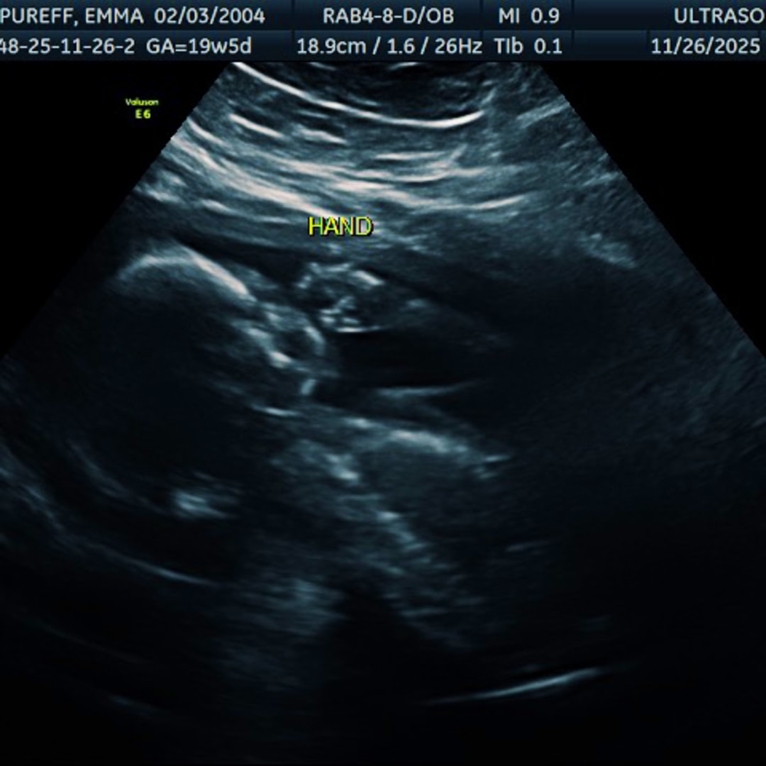 Photo shared by Emma for their Babylist baby registry.