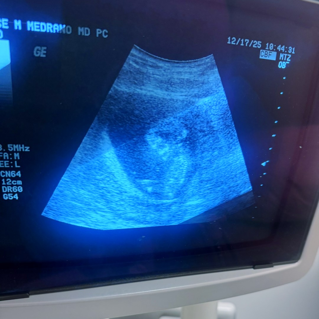 Photo shared by Andrea for their Babylist baby registry.