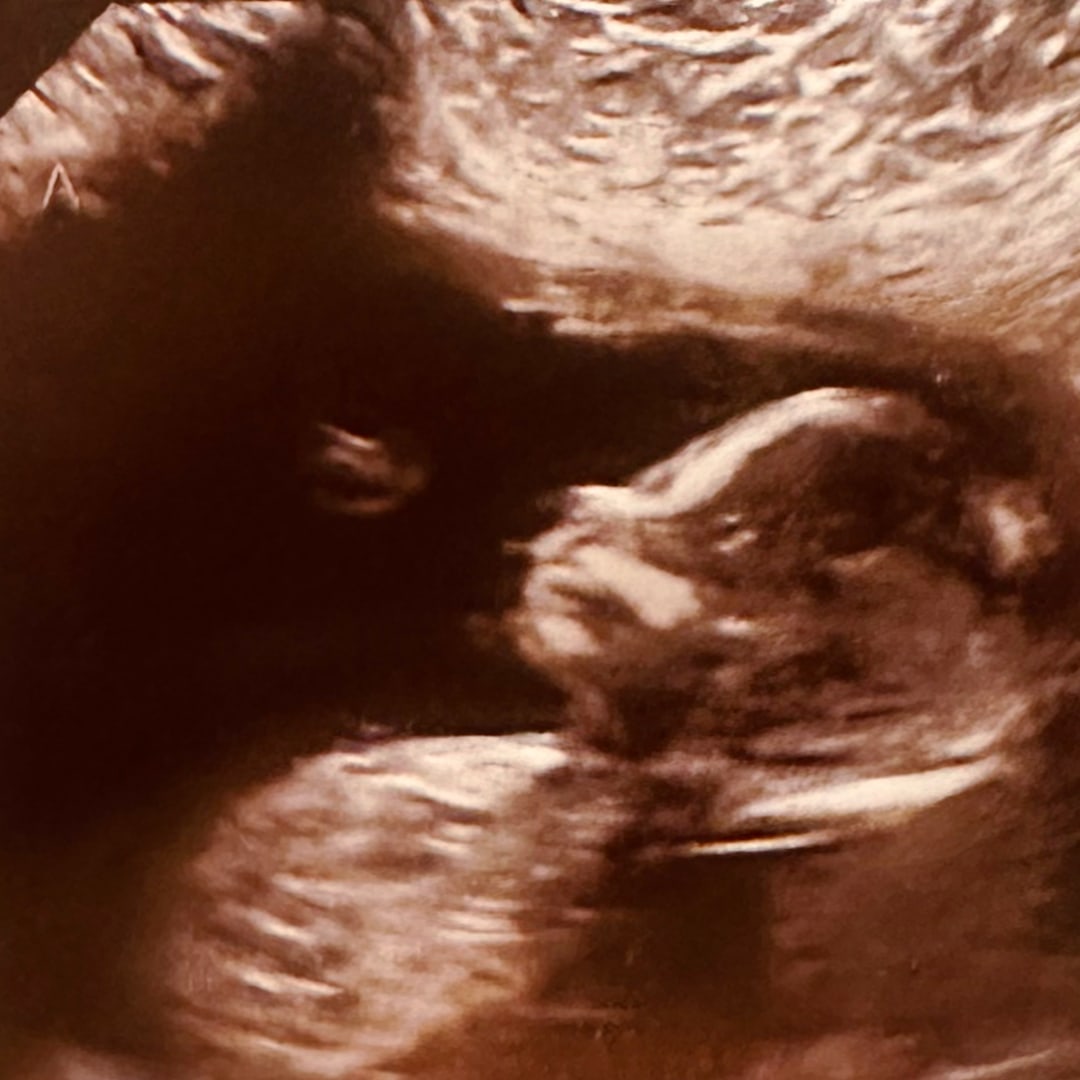 Photo shared by Maura for their Babylist baby registry.