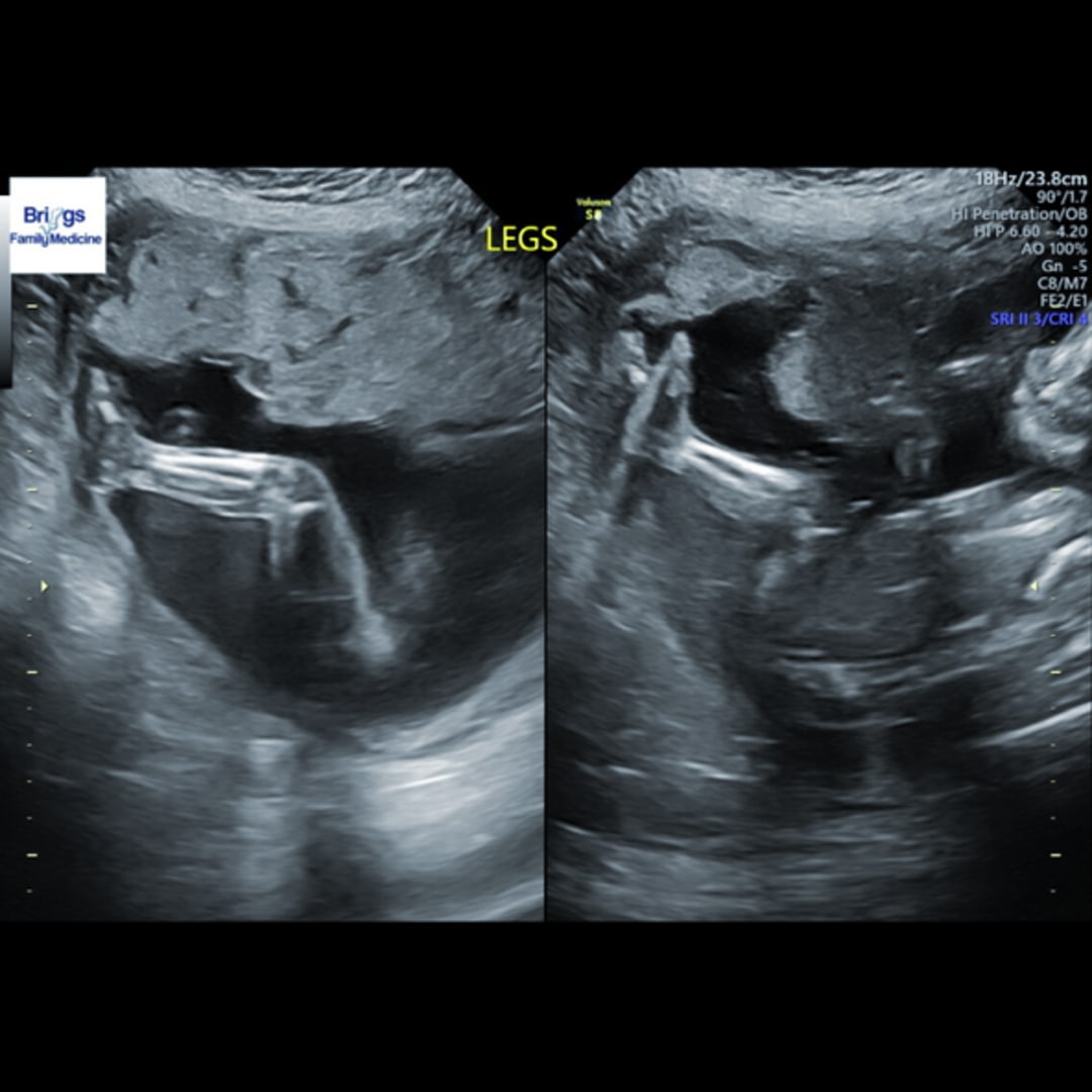 Photo shared by Suvanna for their Babylist baby registry.