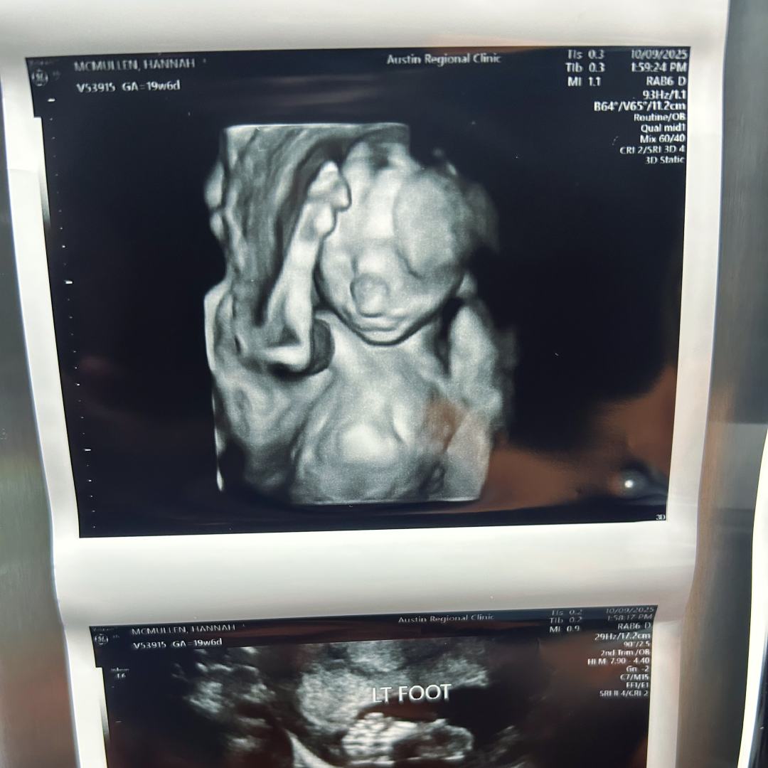 Photo shared by Hannah for their Babylist baby registry.