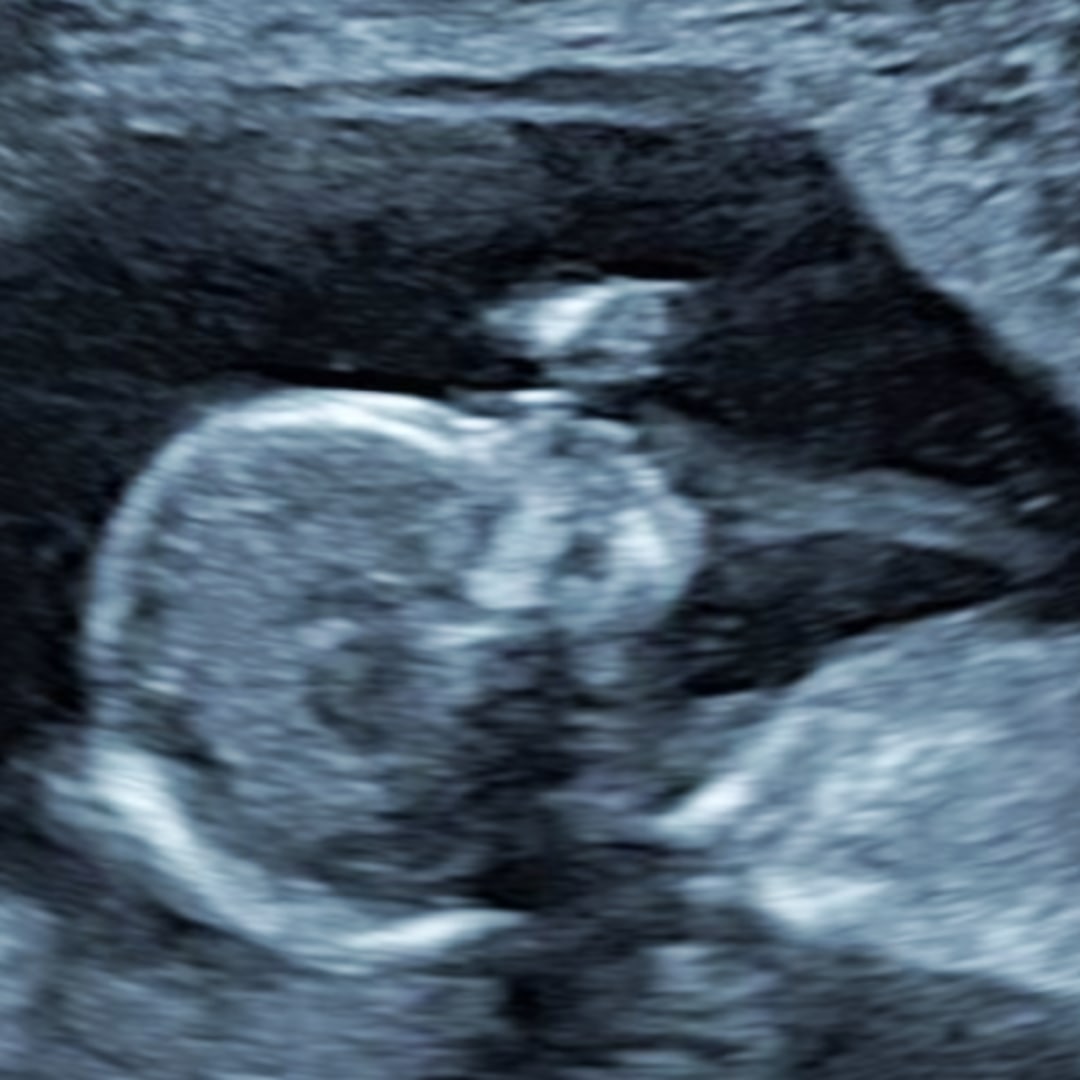 Photo shared by Jana for their Babylist baby registry.