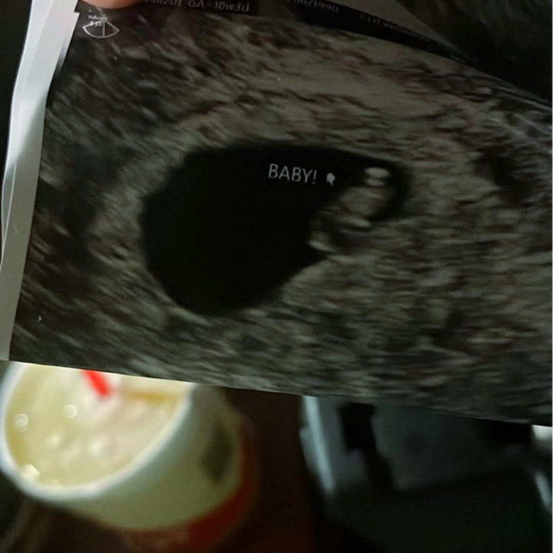 Photo shared by Ashley for their Babylist baby registry.