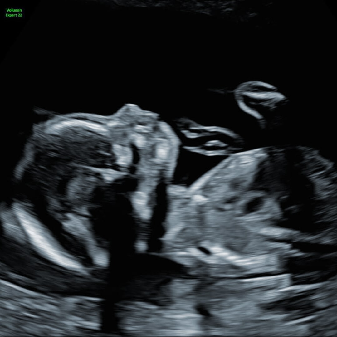 Photo shared by Daniela for their Babylist baby registry.