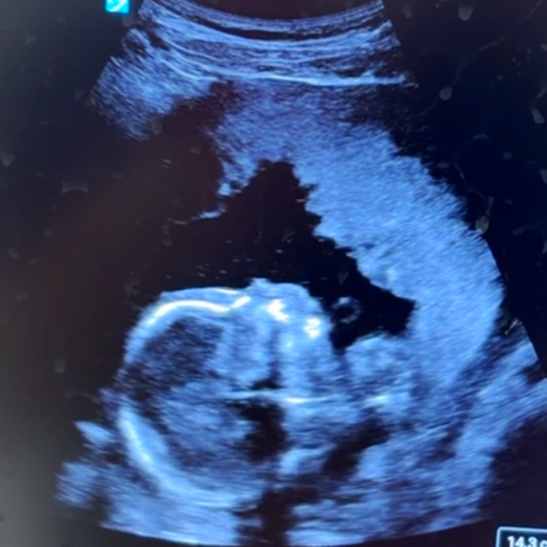 Photo shared by Abigayle for their Babylist baby registry.