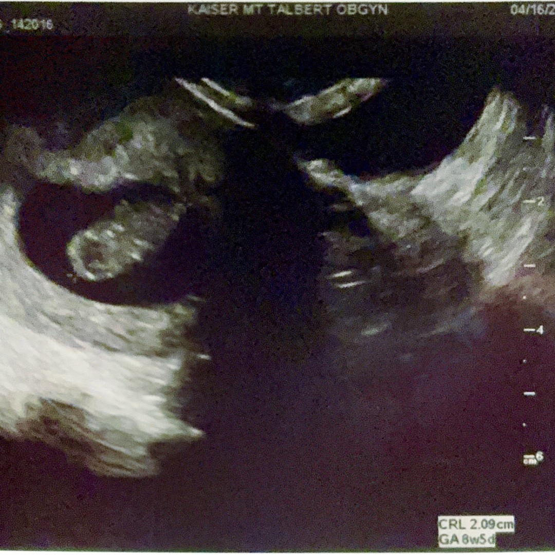 Photo shared by Kaylee for their Babylist baby registry.
