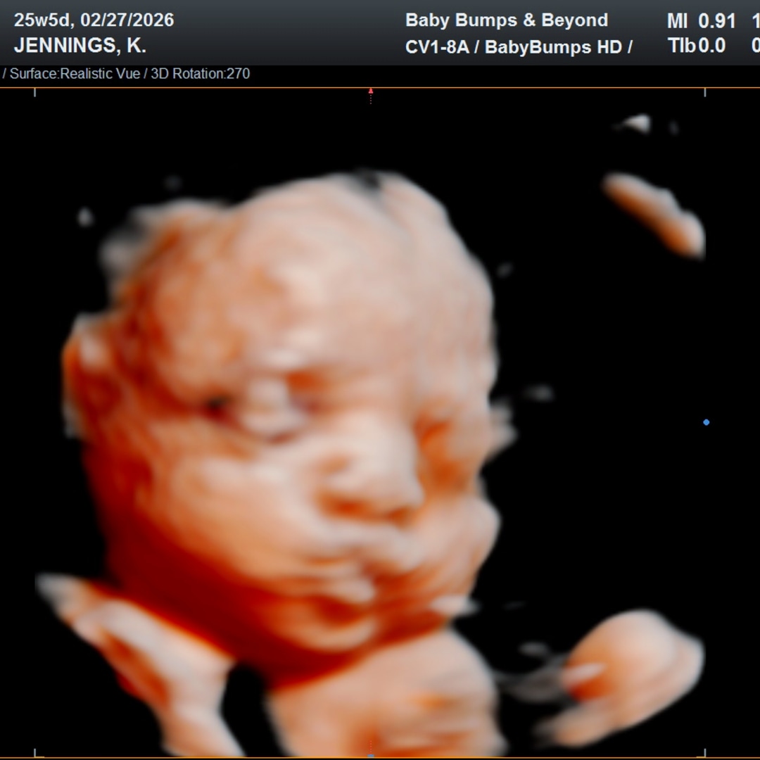 Photo shared by Kaila for their Babylist baby registry.