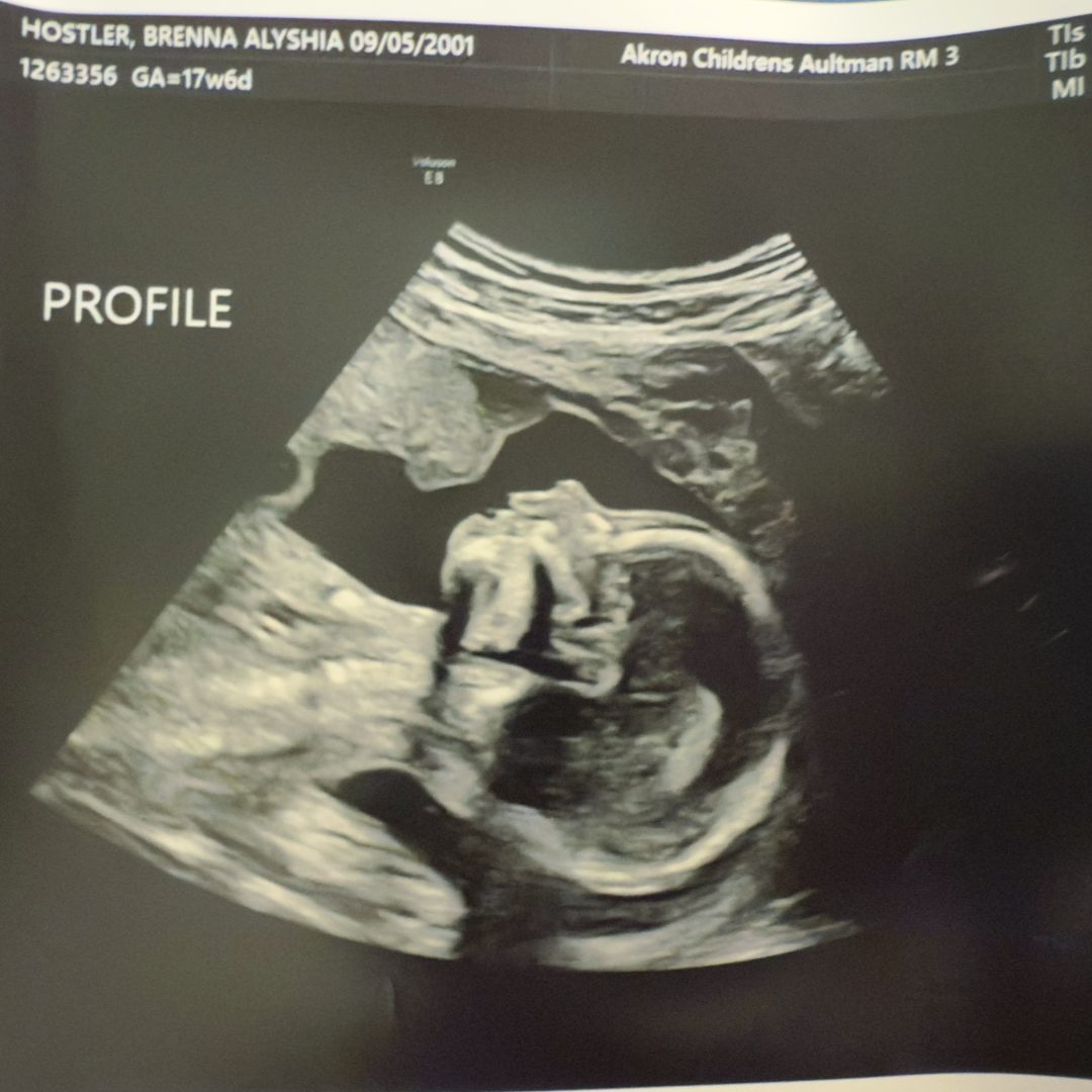 Photo shared by Brenna for their Babylist baby registry.